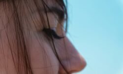 Celebrities With Noonan Syndrome Awareness, Representation & Why Visibility Matters